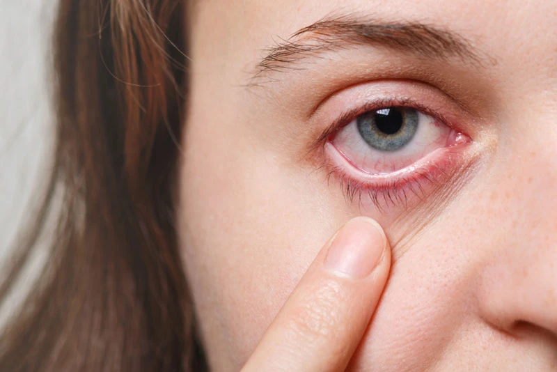 Поширені проблеми та захворювання очей, способи їх запобігання та лікування - фото №4